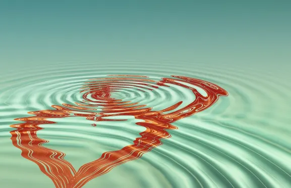 매치북 카지노 지원